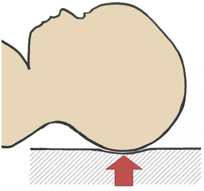 олихоцефалическая форма головы новорожденного