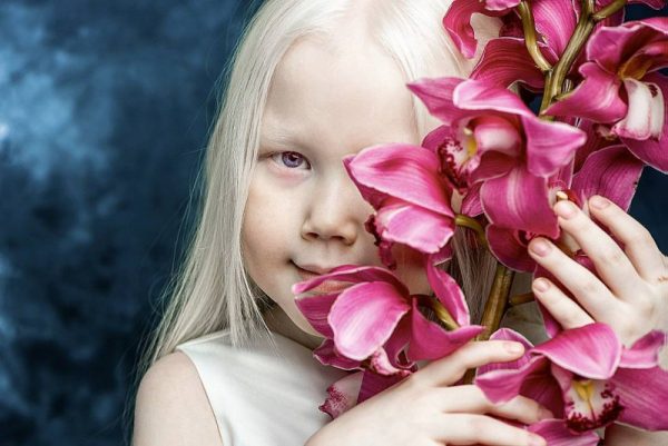 Девочка-альбинос с цветами