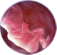 эмбрион на 13 неделе