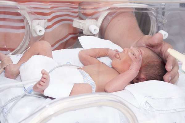 После преждевременных родов ребенка могут поместить в специальную камеру 