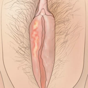 Рисунок малых половых губ