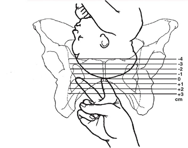 Изображение пальцев и раскрытия шейки матки