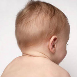 Младенец: асимметрия формы черепа и как с ней справляться