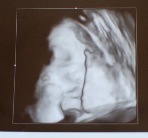 34 week ultrasound