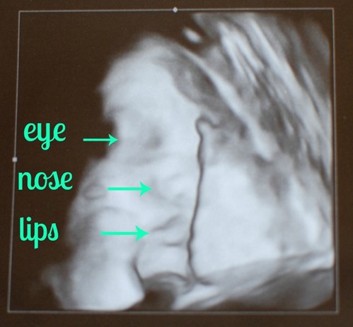 34 week ultrasound pic